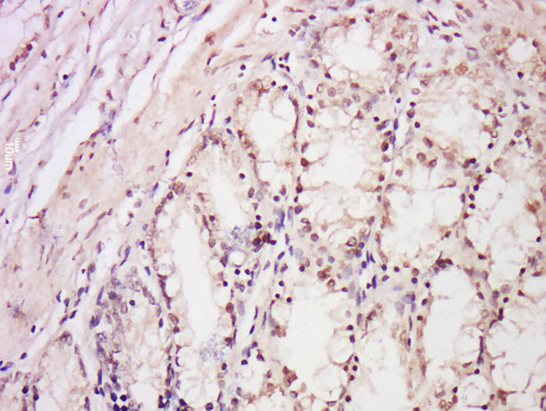 Formalin-fixed and paraffin embedded rat intestine labeled with Anti-DDB2 Polyclonal Antibody, Unconjugated (bs-2599R) at 1:300 followed by conjugation to the secondary antibody and DAB staining.