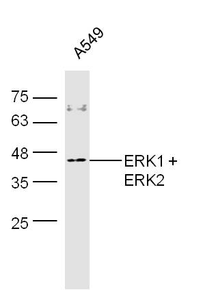 A549 cell lysates probed with Rabbit Anti-ERK1 + 2 Polyclonal Antibody, Unconjugated (bs-2673R) at 1:300 overnight at 4˚C. Followed by conjugation to secondary antibody (bs-0295G-HRP) at 1:500 for 90 min at 37˚C.