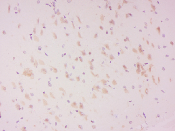Formalin-fixed and paraffin embedded rat brain labeled with Anti-LATS2 (Ser83) Polyclonal Antibody, Unconjugated (bs-4082R) at 1:300 followed by conjugation to the secondary antibody and DAB staining.