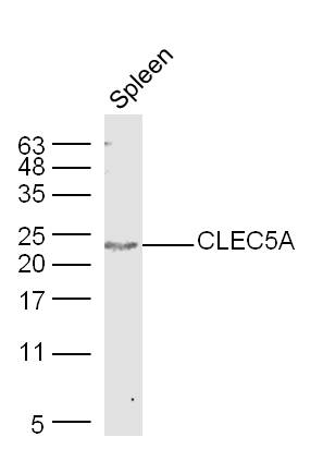Mouse spleen lysates probed with Rabbit Anti-CLEC5A Polyclonal Antibody, Unconjugated (bs-2663R) at 1:300 overnight at 4˚C. Followed by conjugation to secondary antibody (bs-0295G-HRP) at 1:500 for 90 min at 37˚C.