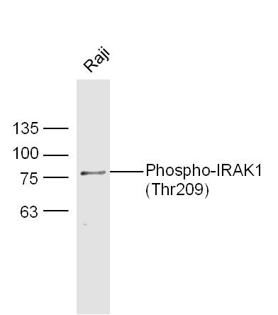 Raji cell lysates probed with Rabbit Anti-IRAK1 (Thr209) Polyclonal Antibody, Unconjugated (bs-3193R) at 1:300 overnight at 4˚C. Followed by conjugation to secondary antibody (bs-0295G-HRP) at 1:500 for 90 min at 37˚C.