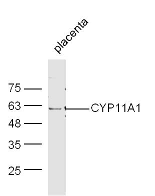 Mouse placenta lysates probed with Rabbit Anti-CYP11A1 Polyclonal Antibody, Unconjugated (bs-3608R) at 1:300 overnight at 4˚C. Followed by conjugation to secondary antibody (bs-0295G-HRP) at 1:500 for 90 min at 37˚C.