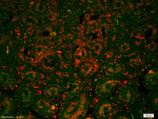 Formalin-fixed and paraffin-embedded mouse intestine labeled with Anti-E cadherin/CD324 Polyclonal Antibody, Unconjugated(bs-10009R) 1:200, overnight at 4°C, The secondary antibody was Goat Anti-Rabbit IgG, Cy3 conjugated(bs-0295G-Cy3)used at 1:200 dilution for 40 minutes at 37°C.