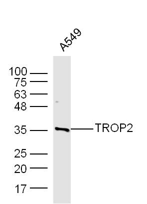 A549 cell lysates probed with Rabbit Anti-TROP2 Polyclonal Antibody, Unconjugated (bs-6198R) at 1:300 overnight at 4˚C. Followed by conjugation to secondary antibody (bs-0295G-HRP) at 1:500 for 90 min at 37˚C.