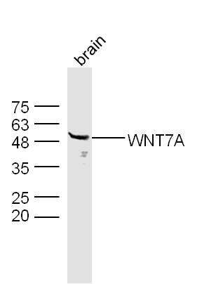 Mouse brain lysates probed with Rabbit Anti-WNT7A Polyclonal Antibody, Unconjugated (bs-6645R) at 1:300 overnight at 4˚C. Followed by conjugation to secondary antibody (bs-0295G-HRP) at 1:500 for 90 min at 37˚C.