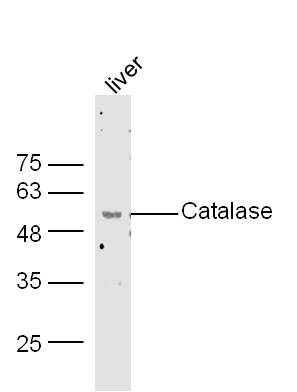 Mouse liver lysates probed with Rabbit Anti-Catalase Polyclonal Antibody, Unconjugated (bs-6874R) at 1:300 overnight at 4˚C. Followed by conjugation to secondary antibody (bs-0295G-HRP) at 1:500 for 90 min at 37˚C.
