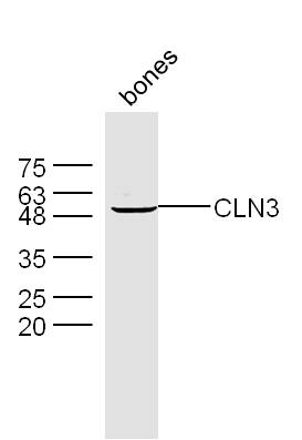 Mouse bone lysates probed with Rabbit Anti-CLN3 Polyclonal Antibody, Unconjugated (bs-8016R) at 1:300 overnight at 4˚C. Followed by conjugation to secondary antibody (bs-0295G-HRP) at 1:500 for 90 min at 37˚C.