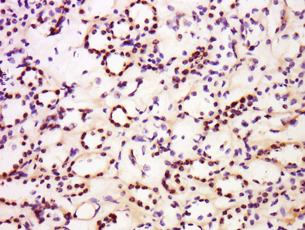 Formalin-fixed and paraffin embedded human kidney labeled with Anti-Nucleophosmin Polyclonal Antibody, Unconjugated (bs-4757R) at 1:300 followed by conjugation to the secondary antibody and DAB staining.
