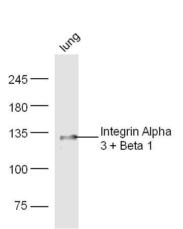 Mouse lung lysates probed with Rabbit Anti-Integrin Alpha 3 + Beta 1 Polyclonal Antibody, Unconjugated (bs-1057R) at 1:300 overnight at 4˚C. Followed by conjugation to secondary antibody (bs-0295G-HRP) at 1:500 for 90 min at 37˚C.