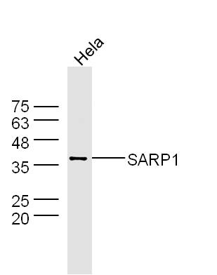 HeLa cell lysates probed with Rabbit Anti-SARP1 Polyclonal Antibody, Unconjugated (bs-9478R) at 1:300 overnight at 4˚C. Followed by conjugation to secondary antibody (bs-0295G-HRP) at 1:500 for 90 min at 37˚C.