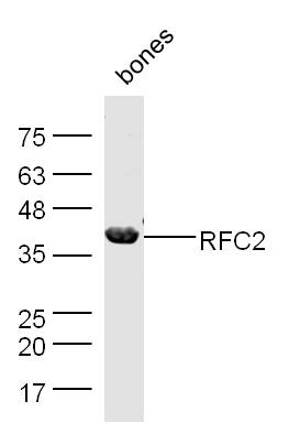 Mouse bone lysates probed with Rabbit Anti-RFC2 Polyclonal Antibody, Unconjugated (bs-11305R) at 1:300 overnight at 4˚C. Followed by conjugation to secondary antibody (bs-0295G-HRP) at 1:500 for 90 min at 37˚C.