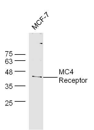 MCF-7 cell lysates probed with Rabbit Anti-MC4 Receptor Polyclonal Antibody, Unconjugated (bs-11417R) at 1:300 overnight at 4˚C. Followed by conjugation to secondary antibody (bs-0295G-HRP) at 1:500 for 90 min at 37˚C.