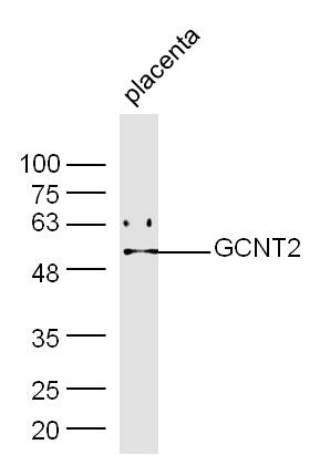 Mouse placenta lysates probed with Rabbit Anti-GCNT Polyclonal Antibody, Unconjugated (bs-13316R) at 1:300 overnight at 4˚C. Followed by conjugation to secondary antibody (bs-0295G-HRP) at 1:500 for 90 min at 37˚C.