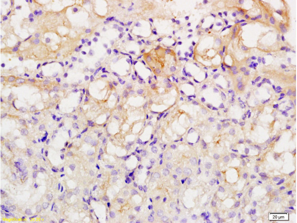 Formalin-fixed and paraffin embedded human kidney tissue labeled with Anti-Acetyl-Histone H1b(K53) Polyclonal Antibody (bs-0931R), Unconjugated at 1:200, followed by conjugation to the secondary antibody and DAB staining