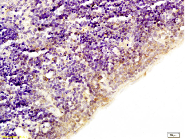 Formalin-fixed and paraffin embedded rat spleen tissue labeled with Anti-Acetyl-Histone H1b(K53) Polyclonal Antibody (bs-0931R), Unconjugated at 1:200, followed by conjugation to the secondary antibody and DAB staining