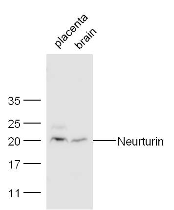Mouse placenta and heart lysates probed with Rabbit Anti-Neurturin Polyclonal Antibody, Unconjugated (bs-0073R) at 1:300 overnight at 4˚C. Followed by conjugation to secondary antibody (bs-0295G-HRP) at 1:500 for 90 min at 37˚C.