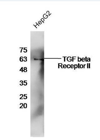HepG2 cell lysates probed with Rabbit Anti-TGF beta R2 Polyclonal Antibody, Unconjugated (bs-0117R) at 1:300 overnight at 4˚C. Followed by conjugation to secondary antibody (bs-0295G-HRP) at 1:500 for 90 min at 37˚C.