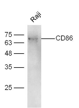 Raji cell lysates probed with CD86 Polyclonal Antibody, Unconjugated (bs-1035R) at 1:300 overnight at 4˚C. Followed by conjugation to secondary antibody (bs-0295G-HRP) at 1:500 for 90 min at 37˚C.
