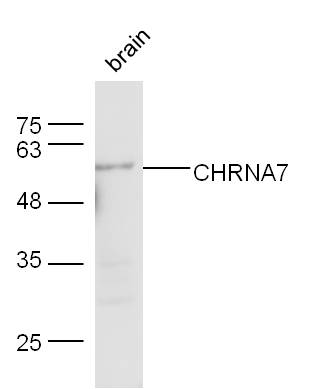 Mouse brain lysates probed with Rabbit Anti-CHRNA7 Polyclonal Antibody, Unconjugated (bs-1049R) at 1:300 overnight at 4˚C. Followed by conjugation to secondary antibody (bs-0295G-HRP) at 1:500 for 90 min at 37˚C.
