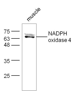 Mouse muscle lysates probed with Rabbit Anti-NADPH oxidase 4 Polyclonal Antibody, Unconjugated (bs-1091R) at 1:300 overnight at 4˚C. Followed by conjugation to secondary antibody (bs-0295G-HRP) at 1:500 for 90 min at 37˚C.