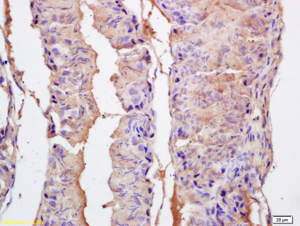 Formalin-fixed and paraffin embedded rat testis labeled with Rabbit Anti EPHA10 Polyclonal Antibody, Unconjugated (bs-10052R) at 1:200 followed by conjugation to the secondary antibody and DAB staining