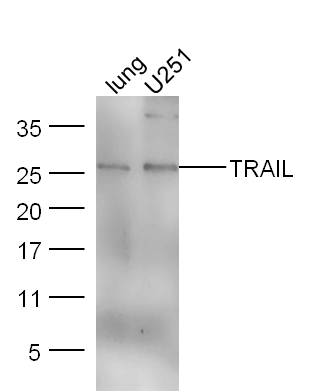 Lane 1: Mouse lung lysates; Lane 2: U251 cell lysates probed with Anti–TRAIL Polyclonal Antibody, Unconjugated (bs-1214R) at 1:300 overnight at 4˚C. Followed by a conjugated secondary antibody (bs-0295G-HRP) at 1:5000 for 90 min at 37˚C.