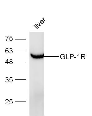 Mouse liver lysates probed with Anti-GLP-1R Polyclonal Antibody, Unconjugated (bs-1559R) at 1:300 overnight at 4˚C. Followed by a conjugated secondary antibody (bs-0295G-HRP) at 1:5000 for 90 min at 37˚C.