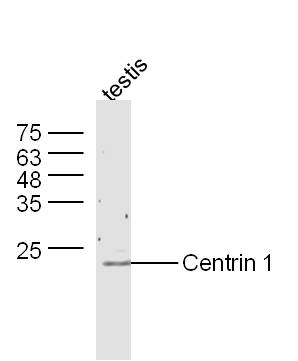 Mouse testis lysates probed with Anti-Centrin 1 Polyclonal Antibody, Unconjugated (bs-10574R) at 1:300 overnight at 4˚C. Followed by a conjugated secondary antibody (bs-0295G-HRP) at 1:5000 for 90 min at 37˚C.