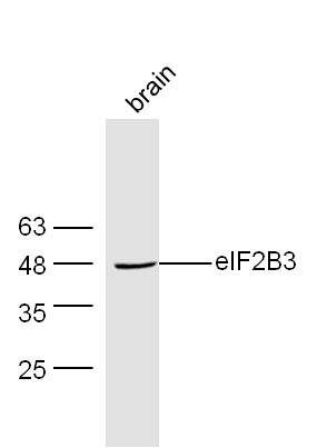 Mouse brain lysates probed with Rabbit Anti-EIF2B3 Polyclonal Antibody, Unconjugated (bs-14537R) at 1:300 overnight at 4˚C. Followed by a conjugated secondary antibody (bs-0295G-HRP) at 1:5000 for 90 min at 37˚C.
