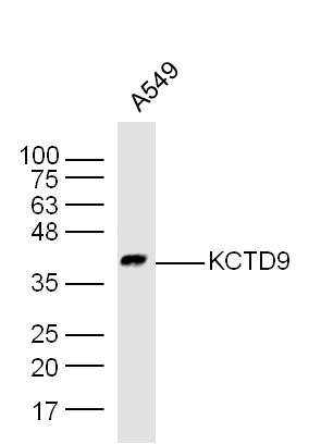 Human A549 cell lysates probed with Rabbit Anti-KCTD9 Polyclonal Antibody, Unconjugated (bs-16937R) at 1:300 overnight at 4˚C. Followed by a conjugated secondary antibody (bs-0295G-HRP) at 1:5000 for 90 min at 37˚C.