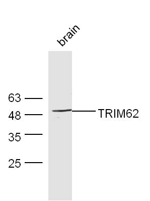 Mouse brain lysates probed with Rabbit Anti-TRIM62 Polyclonal Antibody, Unconjugated (bs-17118R) at 1:300 overnight at 4˚C. Followed by a conjugated secondary antibody (bs-0295G-HRP) at 1:5000 for 90 min at 37˚C.