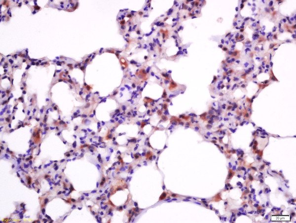 Paraformaldehyde-fixed, paraffin embedded rat lung; Antigen retrieval by boiling in sodium citrate buffer (pH6) for 15min; Block endogenous peroxidase by 3% hydrogen peroxide for 30 minutes; Blocking buffer (normal goat serum) at 37°C for 20min; Antibody incubation with Anti –BAX Polyclonal Antibody, Unconjugated (bs-0127R) at 1:200 overnight at 4°C, followed by a conjugated secondary for 90 minutes and DAB staining