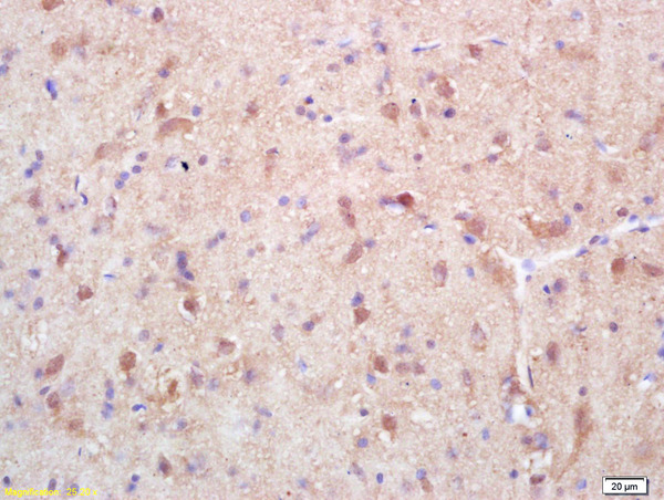 Formalin-fixed and paraffin embedded rat brain labeled with Rabbit Anti Exportin 1/CRM1 Polyclonal Antibody, Unconjugated (bs-10151R) at 1:200 followed by conjugation to the secondary antibody and DAB staining Formalin-fixed and paraffin embedded rat brain labeled with Rabbit Anti Exportin 1/CRM1 Polyclonal Antibody, Unconjugated (bs-10151R) at 1:200 followed by conjugation to the secondary antibody and DAB staining