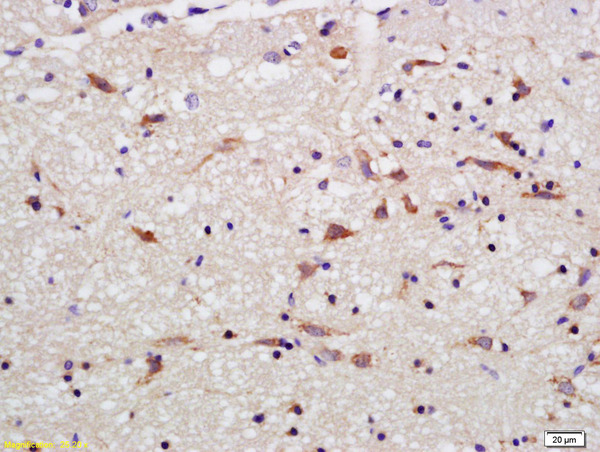 Formalin-fixed and paraffin embedded rat brain labeled with Rabbit Anti OPA1 Polyclonal Antibody, Unconjugated (bs-11764R) at 1:200 followed by conjugation to the secondary antibody and DAB staining