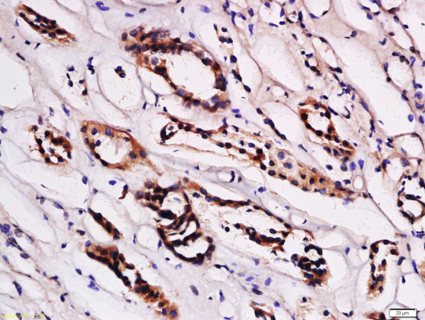 Formalin-fixed and paraffin embedded human kidney labeled with Anti-STRA6 Polyclonal Antibody, Unconjugated (bs-12351R) at 1:200 followed by conjugation to the secondary antibody and DAB staining