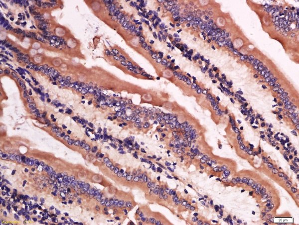 Paraformaldehyde-fixed, paraffin embedded mouse intestine; Antigen retrieval by boiling in sodium citrate buffer (pH6) for 15min; Block endogenous peroxidase by 3% hydrogen peroxide for 30 minutes; Blocking buffer (normal goat serum) at 37°C for 20min; Antibody incubation with Rabbit Anti-Lysozyme Polyclonal Antibody, Unconjugated (bs-0816R) at 1:200 overnight at 4°C, followed by a conjugated \nsecondary for 90 minutes and DAB staining.