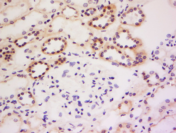 Formalin-fixed and paraffin embedded human kidney labeled with Anti-GRB 14 Polyclonal Antibody, Unconjugated (bs-13641R) at 1:200 followed by conjugation to the secondary antibody and DAB staining.