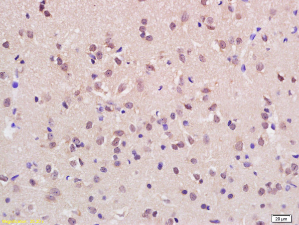 Formalin-fixed and paraffin embedded rat brain labeled with Rabbit Anti KMT2H/ASH1L Polyclonal Antibody, Unconjugated (bs-11866R) at 1:200 followed by conjugation to the secondary antibody and DAB staining