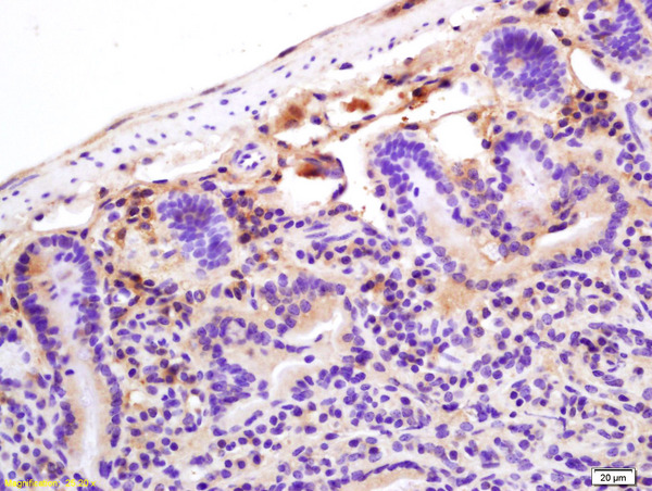 Formalin-fixed and paraffin embedded mouse intestine labeled with  Rabbit Anti CRP Polyclonal Antibody, Unconjugated (bs-0155R) at 1:200 followed by conjugation to the secondary antibody and DAB staining