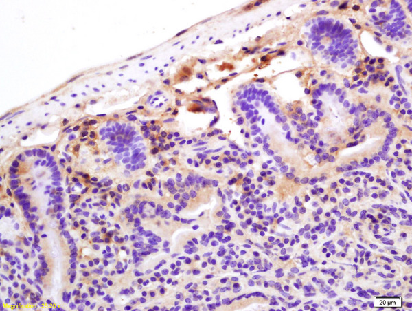 Formalin-fixed and paraffin embedded mouse intestine labeled with Rabbit Anti CRP Polyclonal Antibody, Unconjugated (bs-0155R) at 1:200 followed by conjugation to the secondary antibody and DAB staining