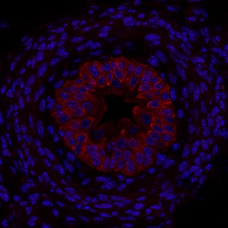 This image was generously submitted by Dr. Guo from Yale School of Medicine. Formalin-fixed and paraffin embedded mouse P1 ureter labeled with Rabbit Anti-Shh Polyclonal Antibody, Unconjugated (bs-1544R).