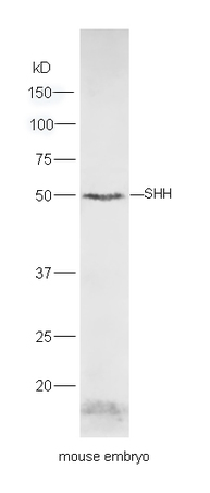 Mouse embryo lysates probed with Rabbit Anti-Shh Polyclonal Antibody, Unconjugated (bs-1544R ) at 1:300 overnight at 4˚C. Followed by conjugation to secondary antibody (bs-0295G-HRP) at 1:5000 for 90 min at 37˚C.