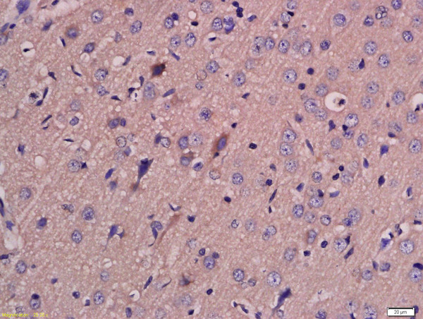 Formalin-fixed and paraffin embedded rat brain labeled with Anti-MCT4 Polyclonal Antibody, Unconjugated (bs-2698R) at 1:200 followed by conjugation to the secondary antibody and DAB staining. Formalin-fixed and paraffin embedded rat brain labeled with Anti-MCT4 Polyclonal Antibody, Unconjugated (bs-2698R) at 1:200 followed by conjugation to the secondary antibody and DAB staining.