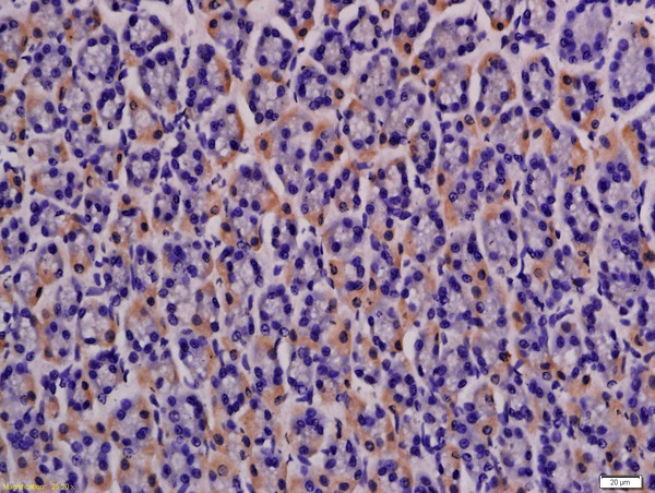 Formalin-fixed and paraffin embedded rat stomach labeled with Anti-MCT4 Polyclonal Antibody, Unconjugated (bs-2698R) at 1:200 followed by conjugation to the secondary antibody and DAB staining.