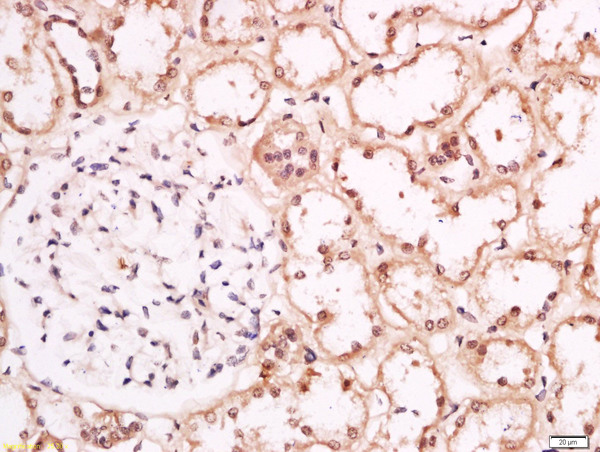 Formalin-fixed and paraffin embedded human kidney labeled with Anti-Torc1 (Ser151) Polyclonal Antibody, Unconjugated (bs-3453R) at 1:200 followed by conjugation to the secondary antibody and DAB staining.
