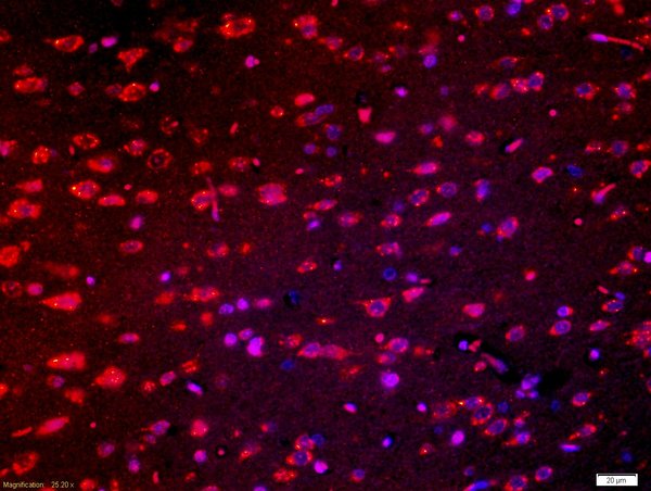 Tissue: rat brain tissue; 4% Paraformaldehyde-fixed and paraffin-embedded; \nAntigen retrieval: citrate buffer (0.01M, pH 6.0), Boiling bathing for 15min; Blocking buffer (normal goat serum 5%) at 37℃ for 20 min; \nIncubation: Anti-Robo Polyclonal Antibody, Unconjugated (bs-5794R) 1:200, overnight at 4°C; The secondary antibody was Goat Anti-Rabbit IgG, Cy3 conjugated(bs-0295G-Cy3)used at 1:200 dilution for 40 minutes at 37°C. DAPI(5ug/ml,blue) was used to stain the cell nuclei.