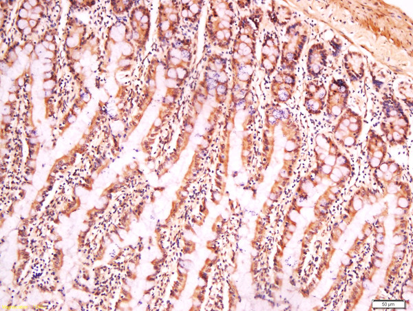 Formalin-fixed and paraffin embedded mouse intestine labeled with Anti-Cryopyrin Polyclonal Antibody, Unconjugated (bs-10021R) at 1:200 followed by conjugation to the secondary antibody and DAB staining.