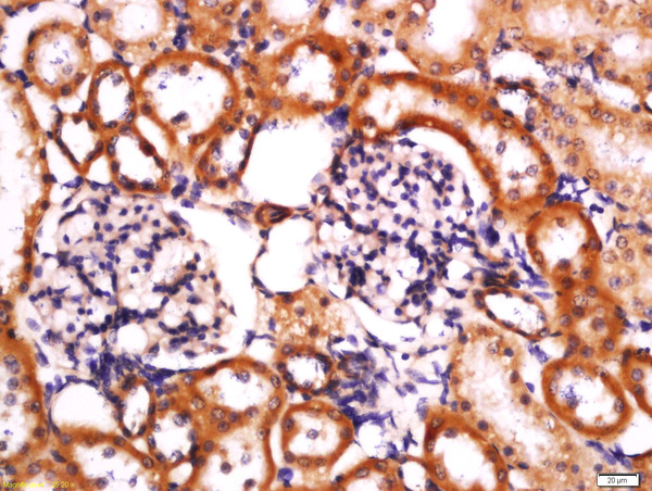 Formalin-fixed and paraffin embedded rat kidney labeled with Anti-Cryopyrin Polyclonal Antibody, Unconjugated (bs-10021R) at 1:200 followed by conjugation to the secondary antibody and DAB staining.