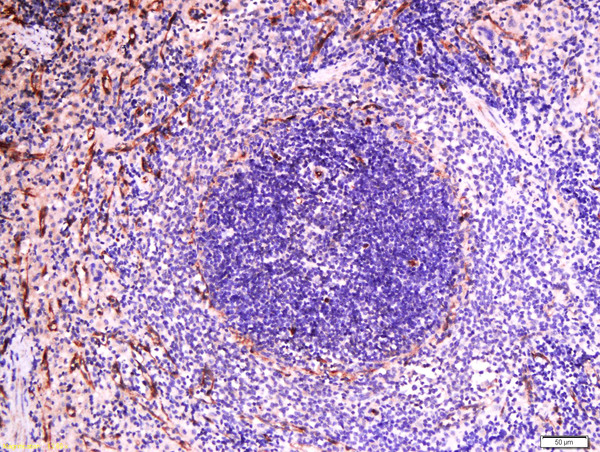 Formalin-fixed and paraffin embedded rat spleen labeled with Anti-Sialoadhesin Polyclonal Antibody, Unconjugated (bs-10751R) at 1:500 followed by conjugation to the secondary antibody and DAB staining