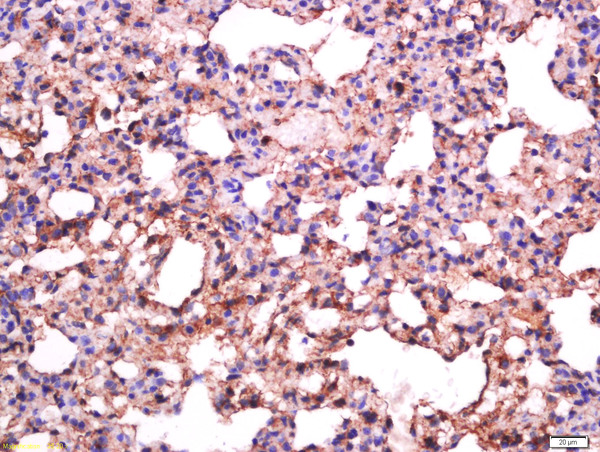 Formalin-fixed and paraffin embedded rat lung labeled with Anti-Sialoadhesin Polyclonal Antibody, Unconjugated (bs-10751R) at 1:500 followed by conjugation to the secondary antibody and DAB staining